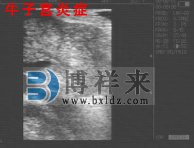 母牛子宮炎癥B超圖