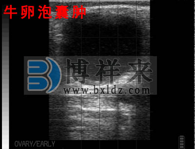 牛用B超檢測母牛卵泡囊腫B超影像圖