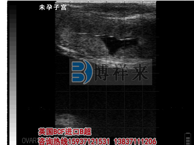 牛用B超檢測未孕子宮影像圖 